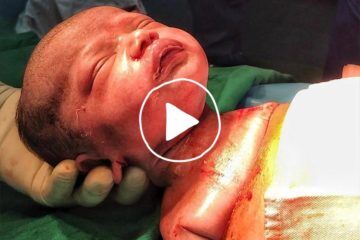 gentle calm csection