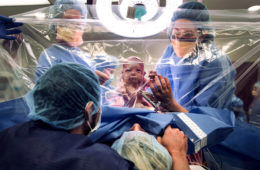 c-section clear drape c-section