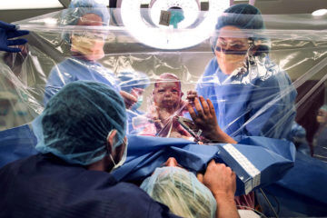 c-section clear drape c-section