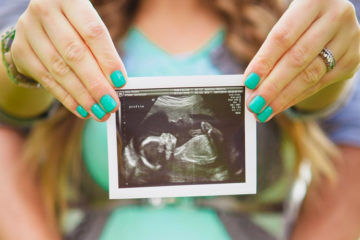Ultrasound image birth announcement