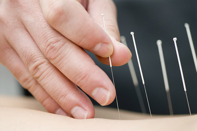 Acupuncture for pregnancy