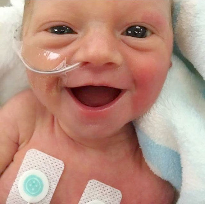smiling premature baby
