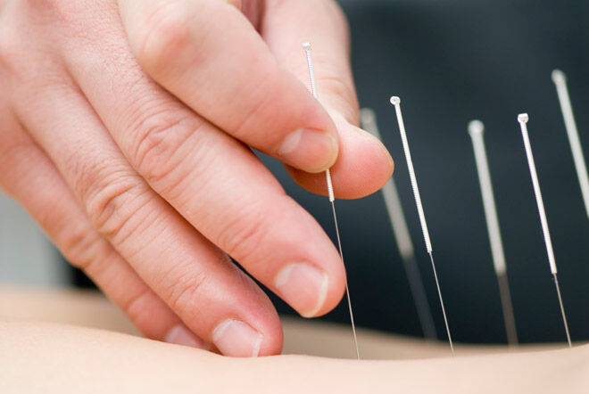 unsafe therapies for pregnancy acupuncture