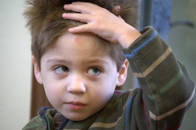 parents guide to child head injuries