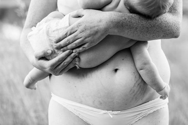 real mum bodies after baby stretchmarks