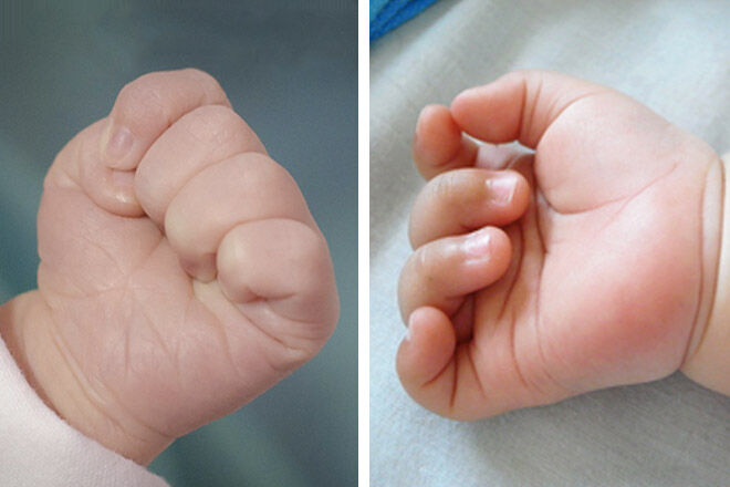 baby fists open and closed