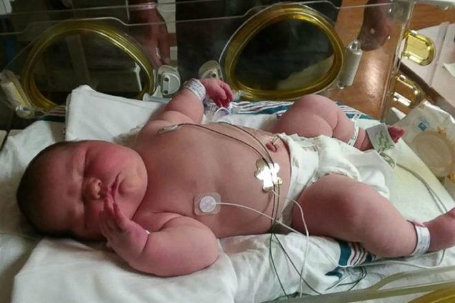 Carleigh Corbitt at birth in hospital