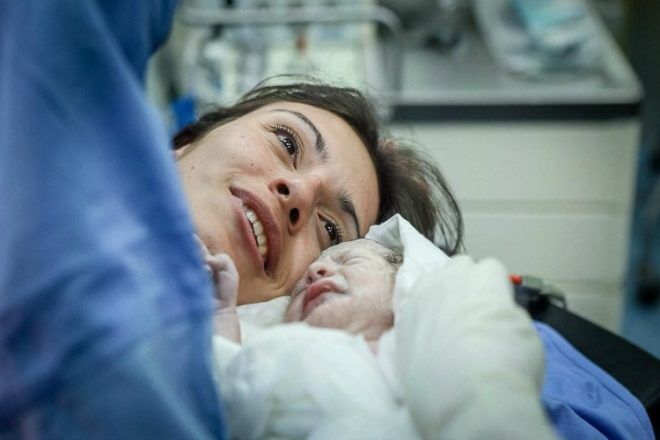 what mums say about c-sections
