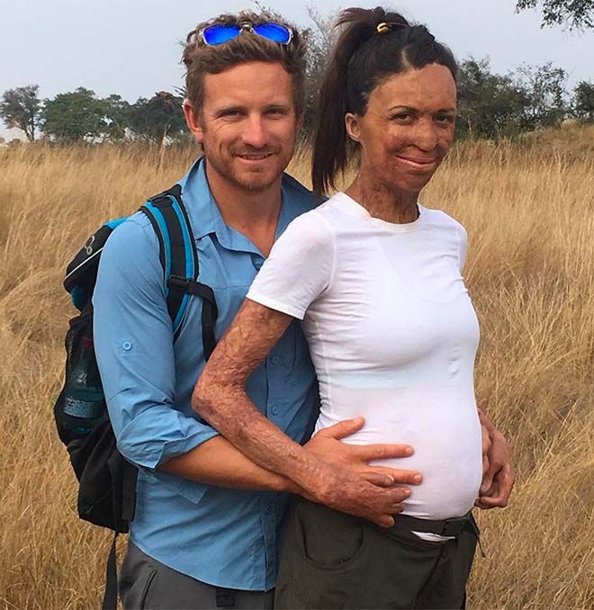 Turia Pitt shows her gorgeous baby bump