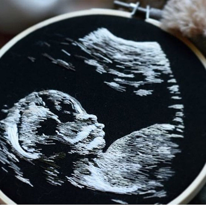 Ultrasound embroidery