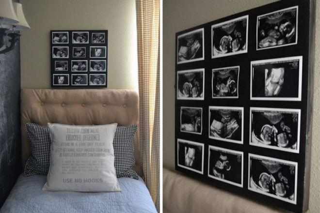 use baby ultrasound scan photo as artwork