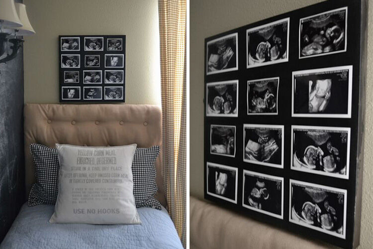 7 Creative Ways To Display An Ultrasound Photo Mum S Grapevine   Art Canvas 