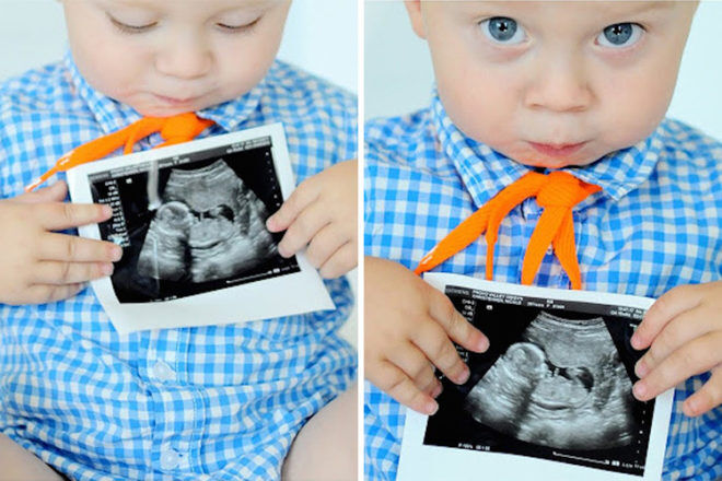 use baby ultrasound scan photo with sibling