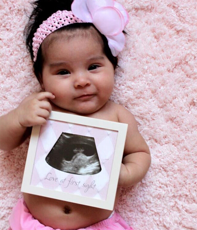use baby ultrasound scan photo as newborn photoshoot