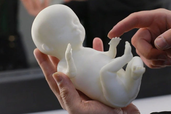 3D baby printing
