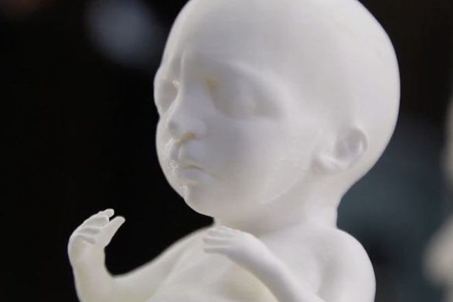 3D printed baby from ultrasound