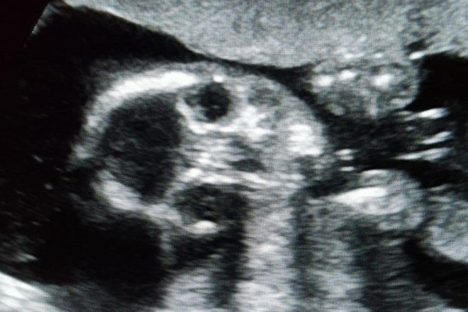 Freaky ultrasound images