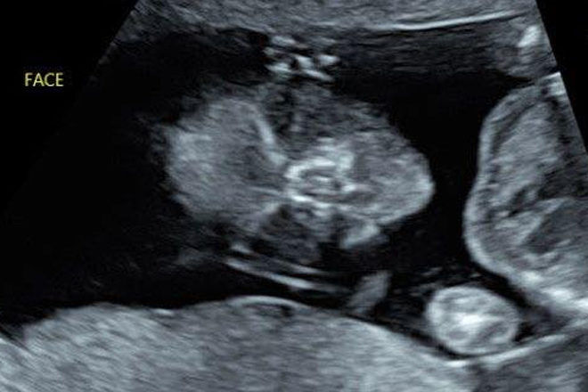 Mums reveal strange ultrasound pictures