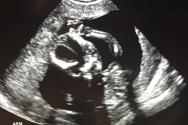 Freaky ultrasound images