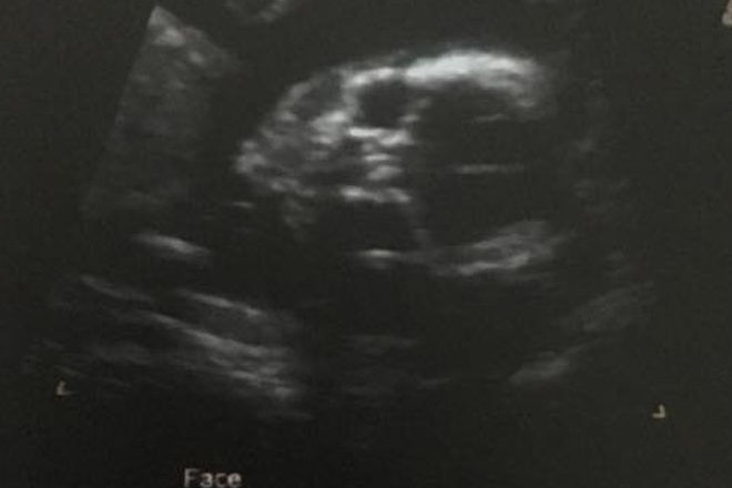 Creepy ultrasound images