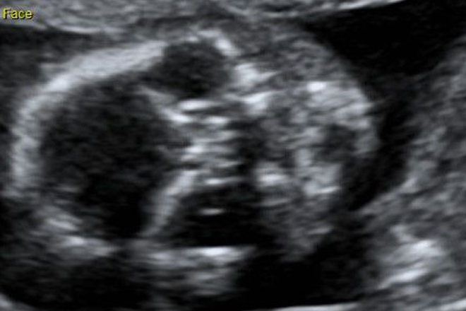 Scary ultrasound images