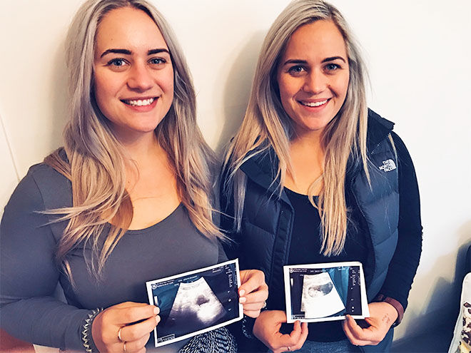 Twin sisters pregnancy