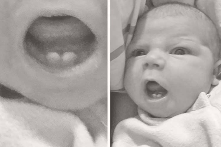 Meet the baby born with teeth, Evie Carter Mum's Grapevine