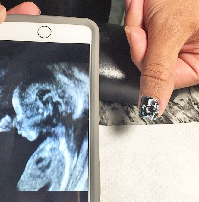 Nail art ultrasounds
