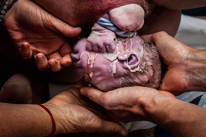 Belle Verdiglione birth photography