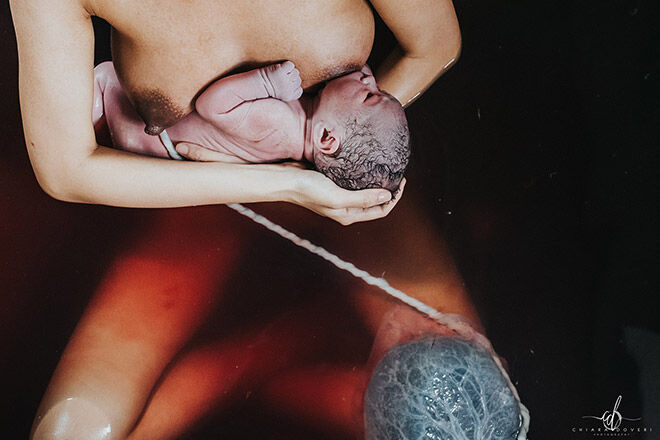 Water birth photo winner