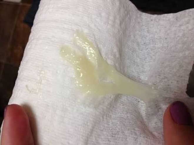 What does a mucus plug look like