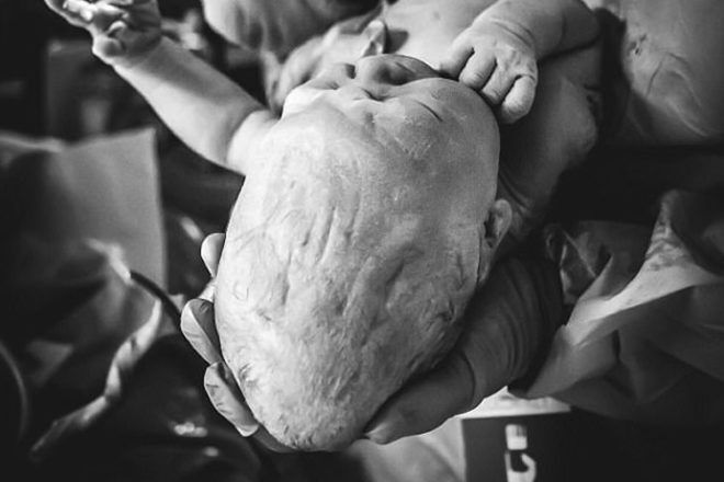Baby's head after birth K Reeder Photography