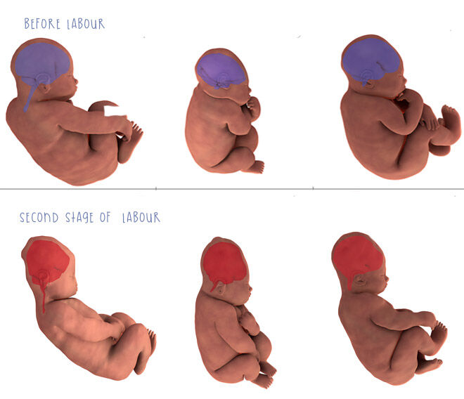 Baby's head during labour