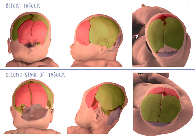 Baby's head during birth