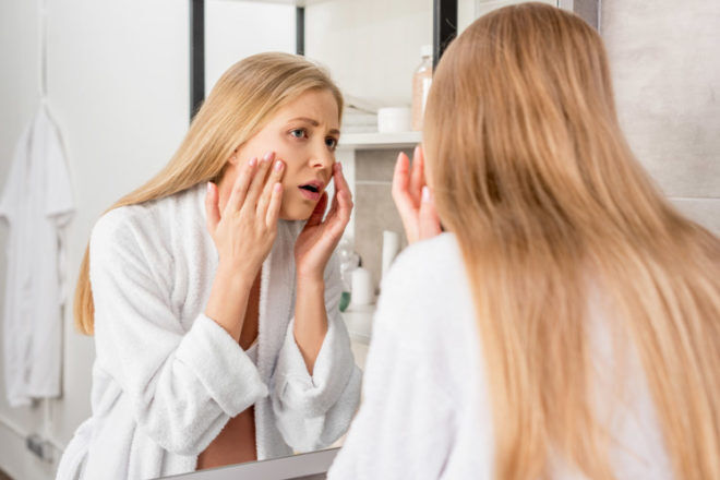 Acne during pregnancy could be a sign of baby's gender
