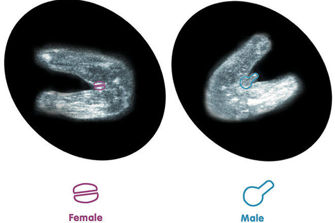 How to tell gender from 12 week ultrasound