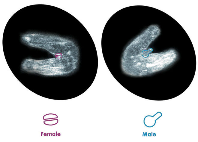 How To Predict Baby S Gender From An Early Ultrasound Mum S Grapevine