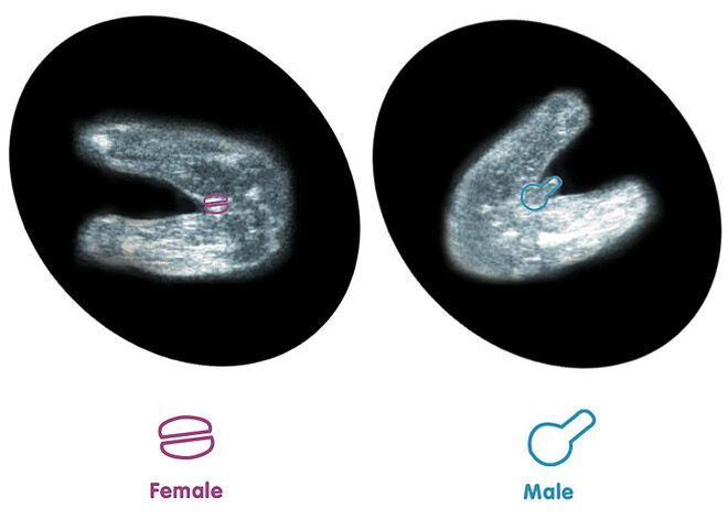 How to tell gender from 12 week ultrasound