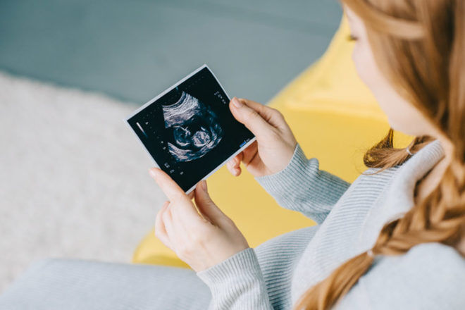 Signs that baby is a boy or girl from early ultrasound | Mum's Grapevine