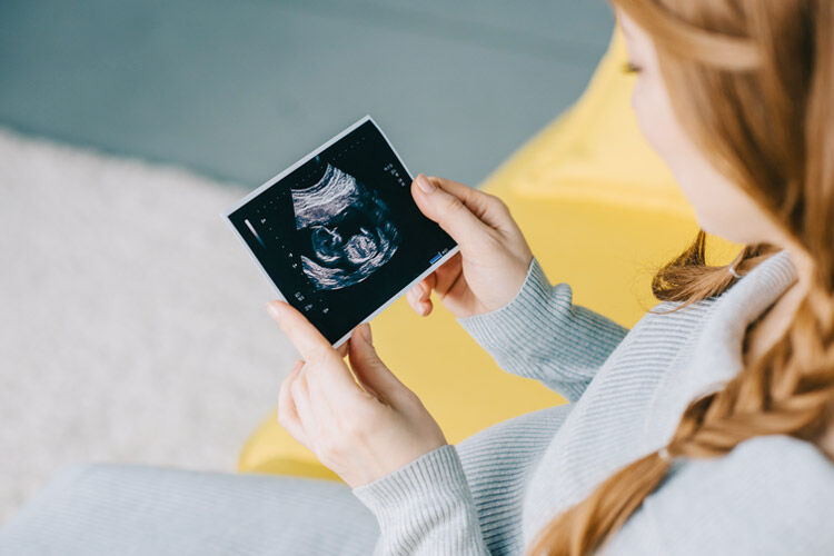 how-to-predict-baby-s-gender-from-an-early-ultrasound