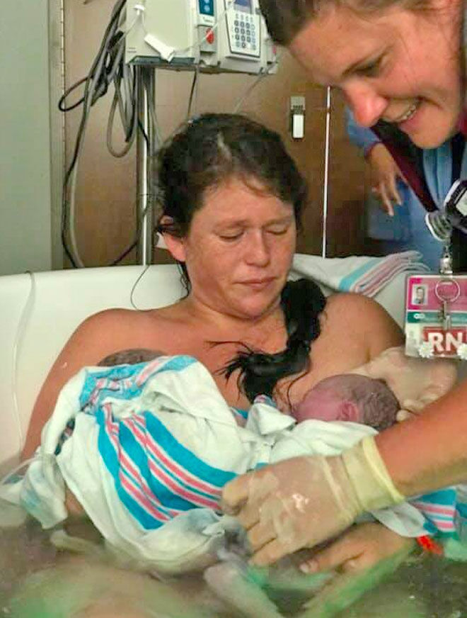 Birth story twins surprise