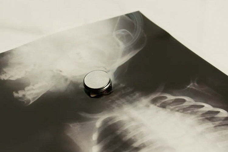 Button Battery Warning Hidden Dangers for Kids