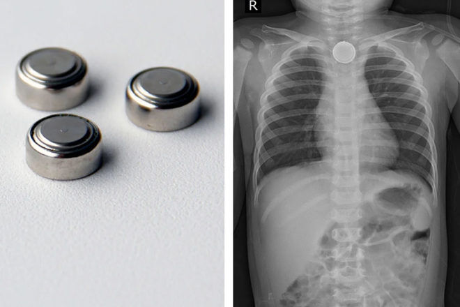 ACCC issues warning about button batteries | Mum's Grapevine
