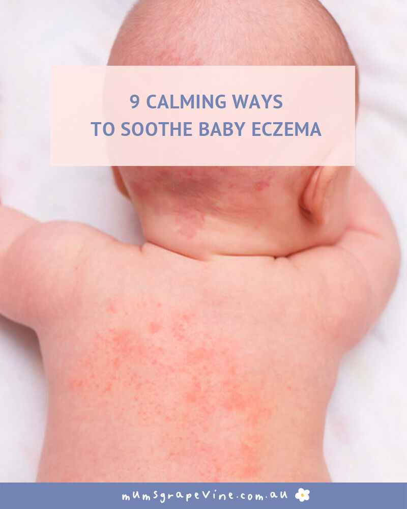 Soothe baby eczema