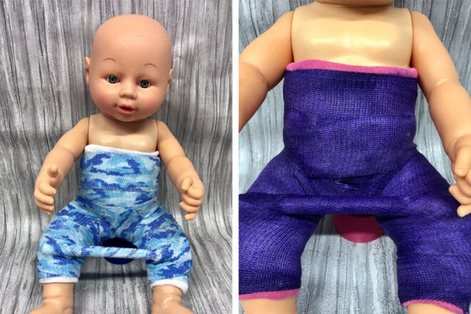 Hip dysplasia cast doll