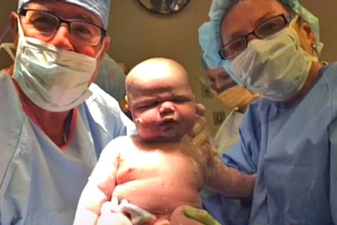 Birth story 14 pound baby