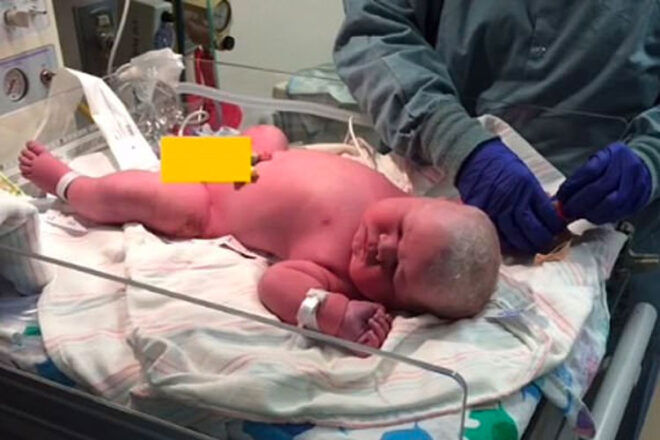 Birth story 14 pound newborn
