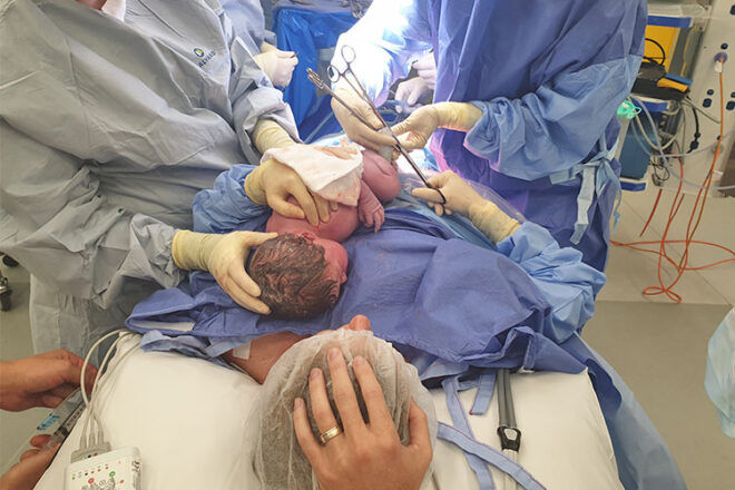 Birth Story Bec Warn maternal assisted caesarean 3