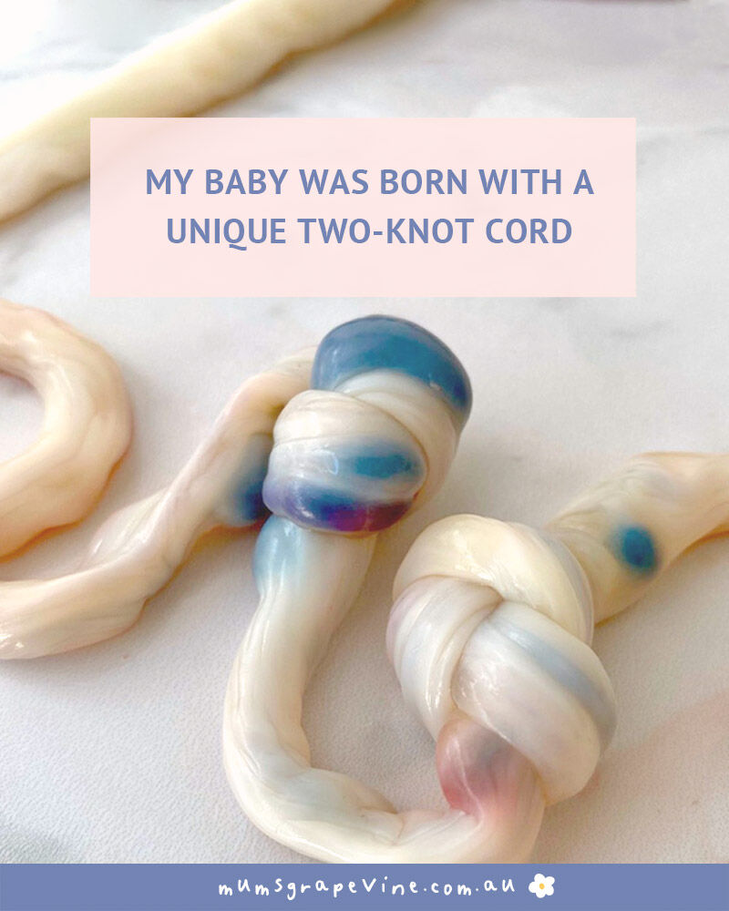 Birth Story: Baby born with double Knot Cord | Mum's Grapevine