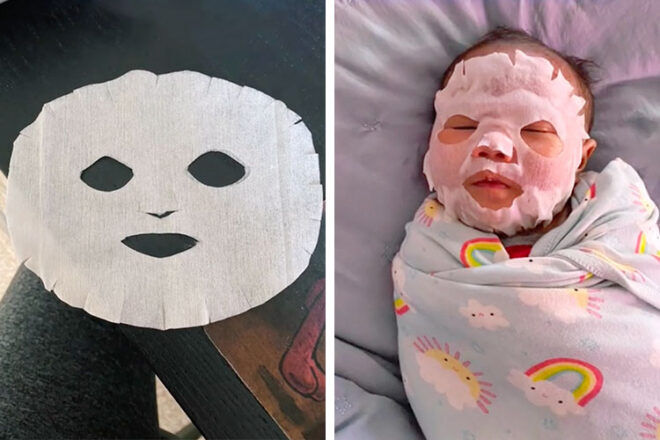 Baby acne breastmilk mask